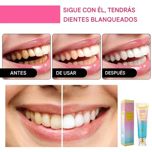 Pasta dental blanqueadora triple con niacinamida y sin flúor