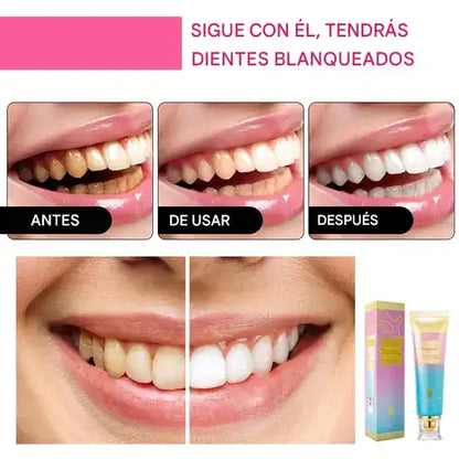 Pasta dental blanqueadora triple con niacinamida y sin flúor